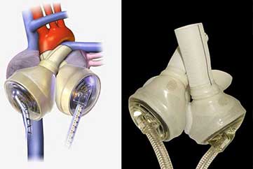 inżynieria medyczna
