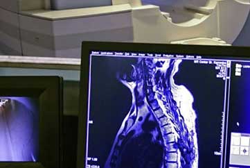 zdjęcie rentgenowskie odcinka szyjnego kręgosłupa