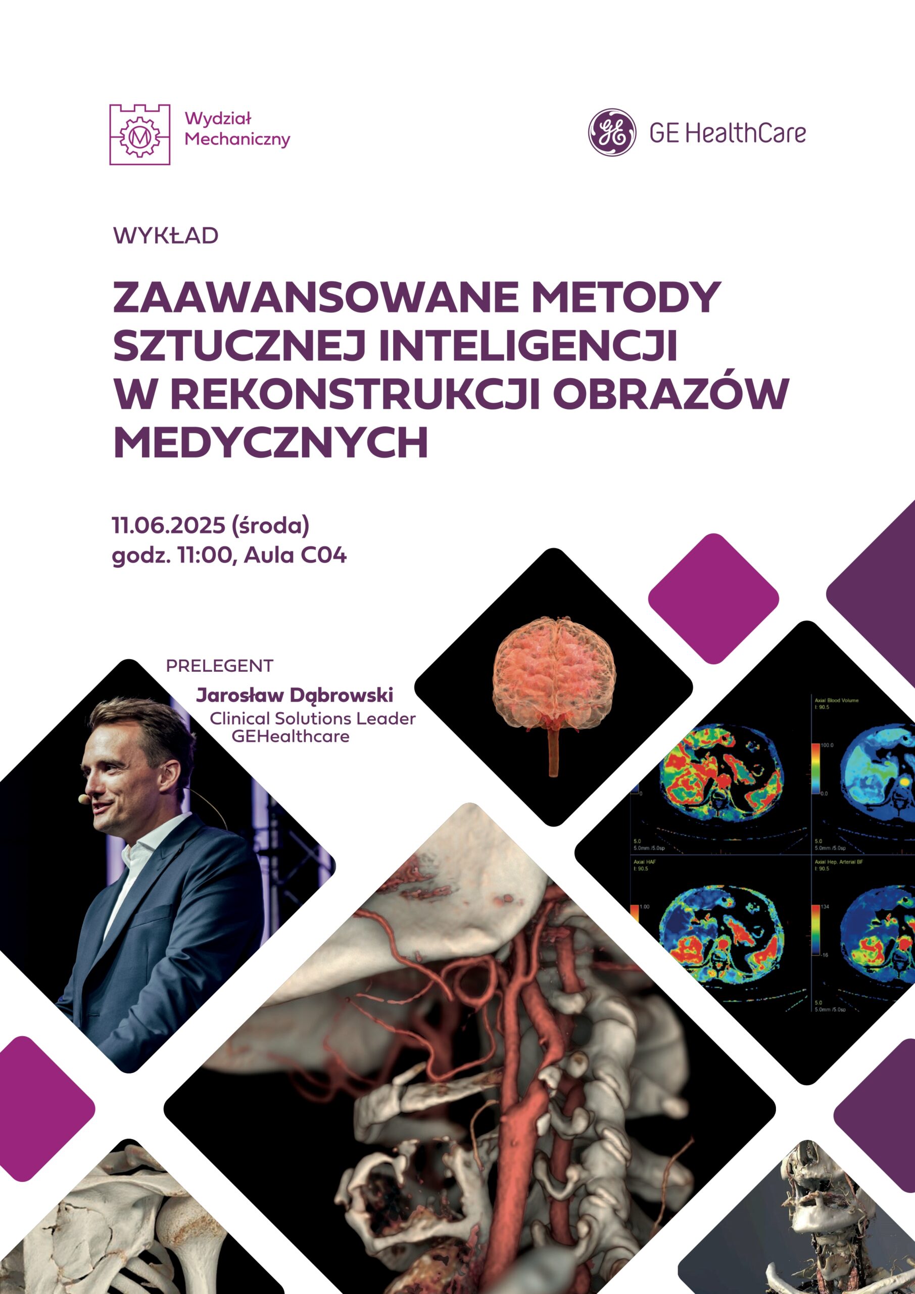 Sztuczna inteligencja w służbie medycyny – wykład i warsztaty z GE Healthcare